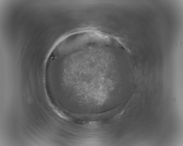 X0000061150056200512022325