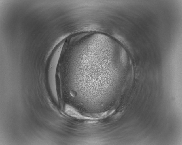 X0000061150060200512022325