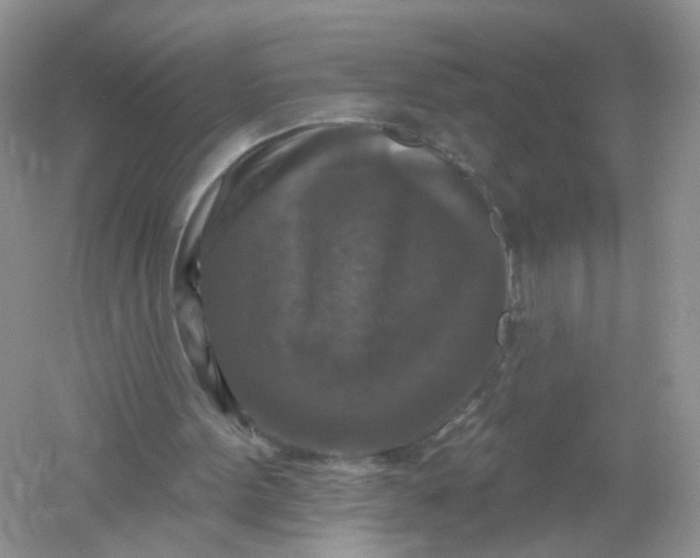 X0000061150099200512022325