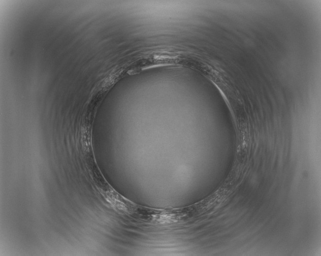 X0000061150419200512022319