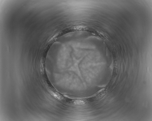 X0000061150572200512022317