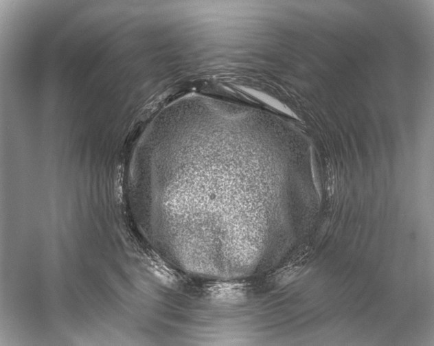 X0000061150664200512022316