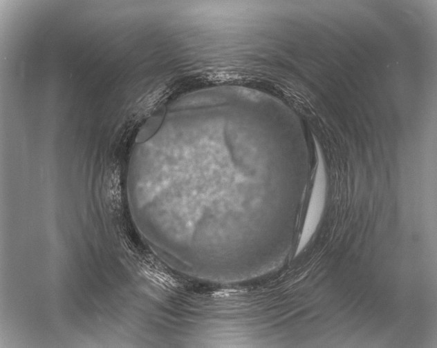 X0000061150700200512022314