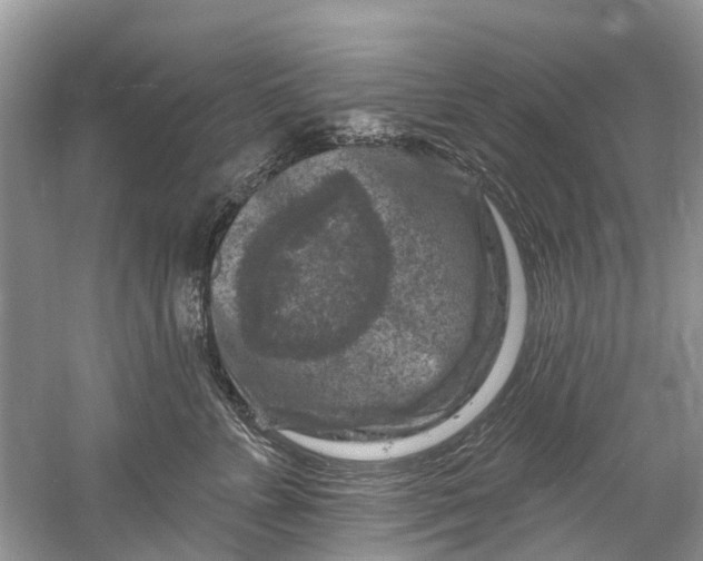 X0000061150715200512022314