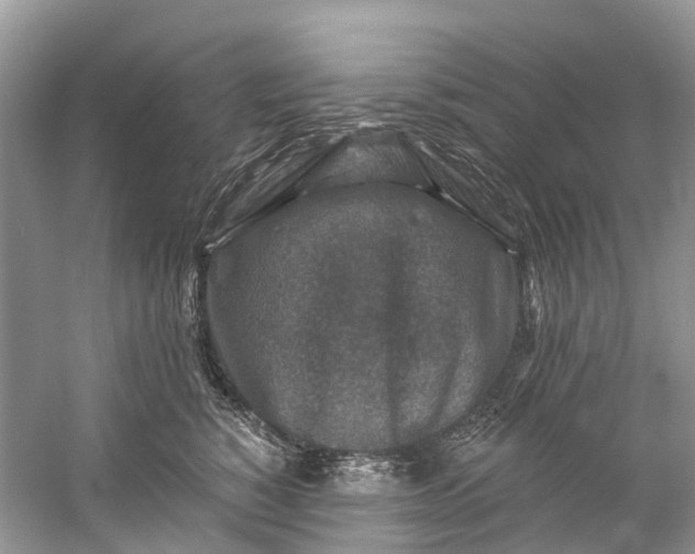 X0000061150760200512022314