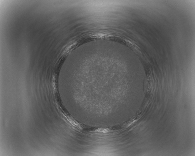 X0000061150762200512022314