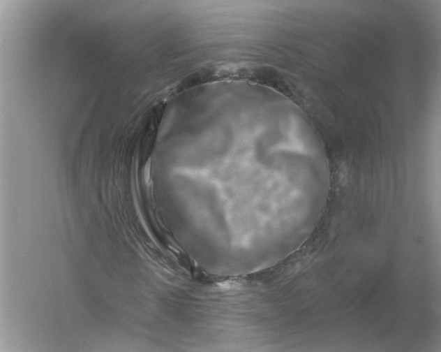 X0000061150914200512022310