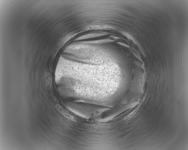 X0000061151025200512022309