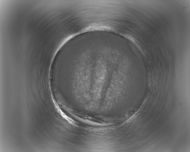 X0000061151038200512022309