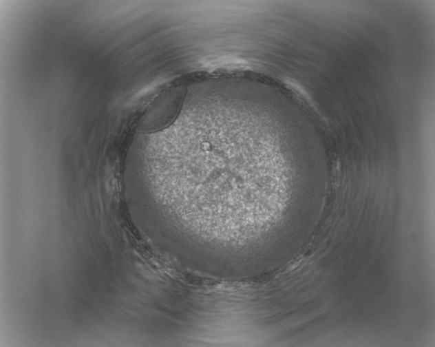 X0000061151063200512022308