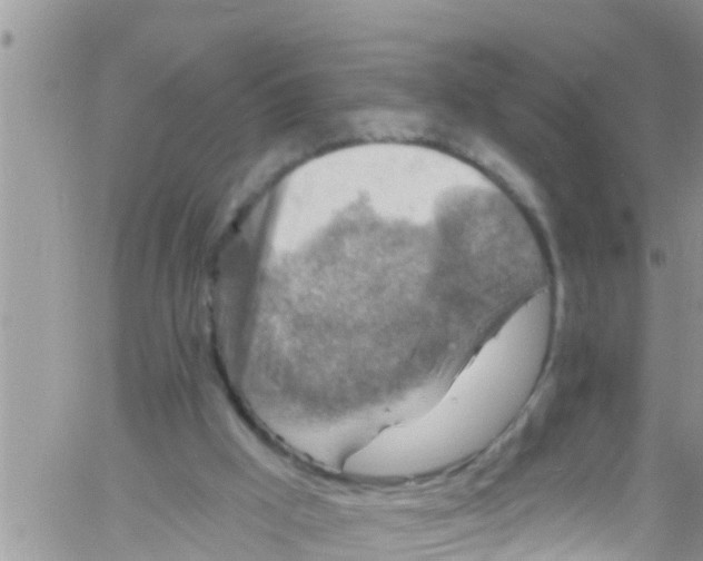 X0000061150009200512092011