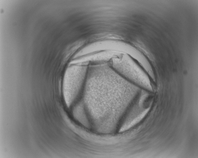 X0000061150014200512092011