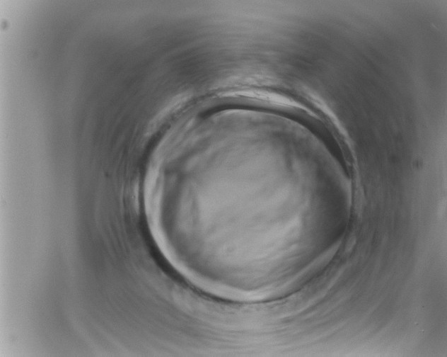 X0000061150019200512092011