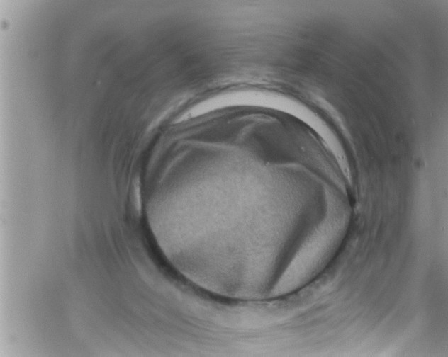 X0000061150020200512092011