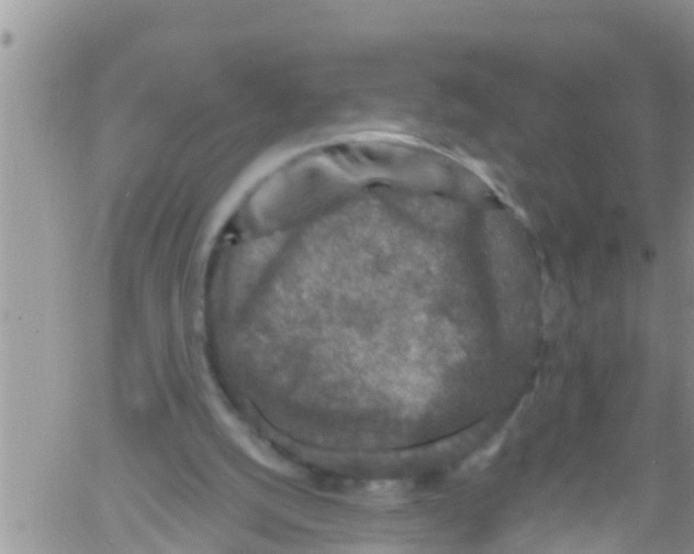 X0000061150056200512092010