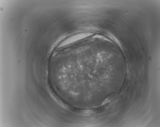 X0000061150059200512092010