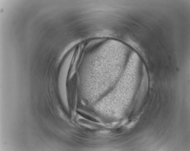 X0000061150060200512092010