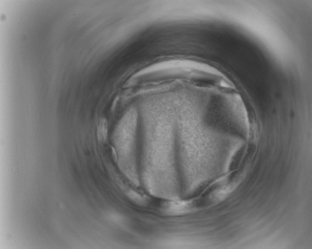 X0000061150093200512092010