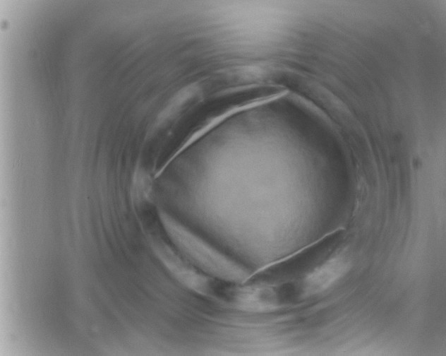 X0000061150096200512092010