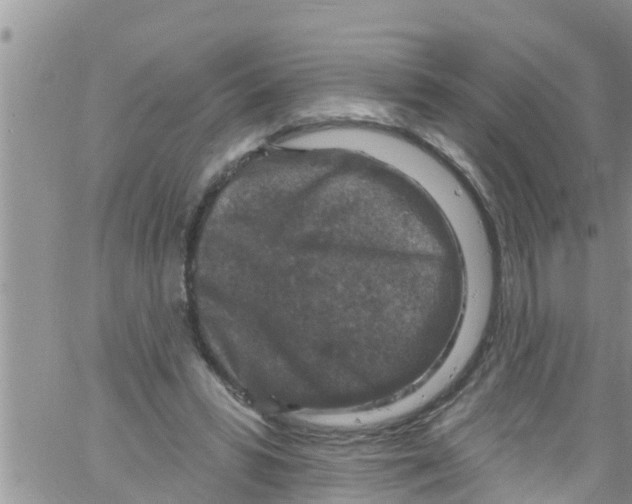 X0000061150399200512092004