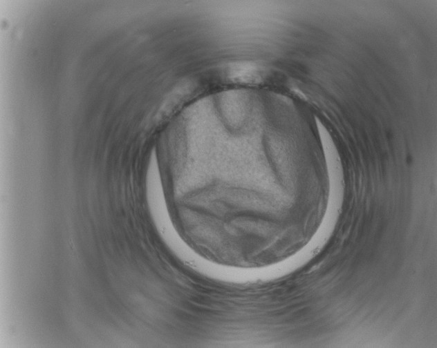 X0000061150424200512092004