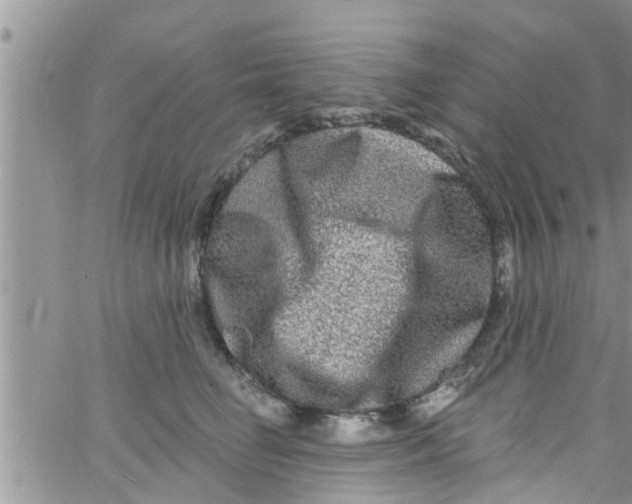 X0000061150662200512092000