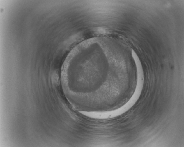 X0000061150715200512091959