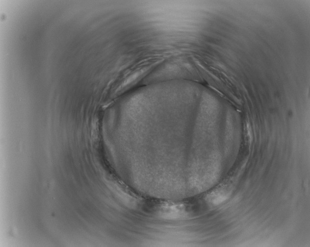 X0000061150760200512091959