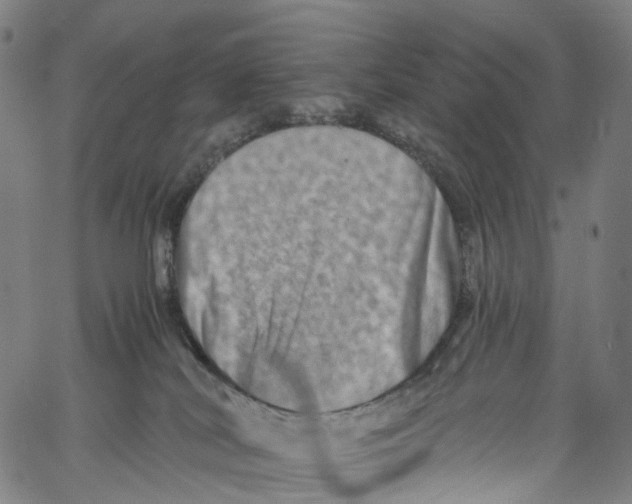 X0000061150038200512161607