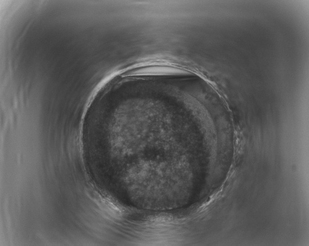 X0000061720200200512050916