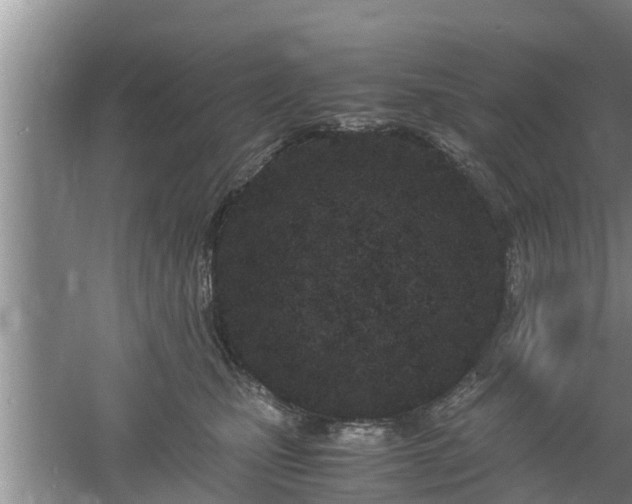 X0000061720471200512050911