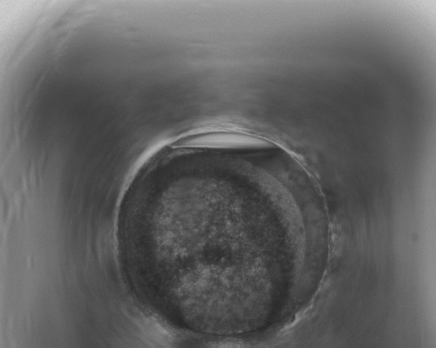 X0000061720200200512092009