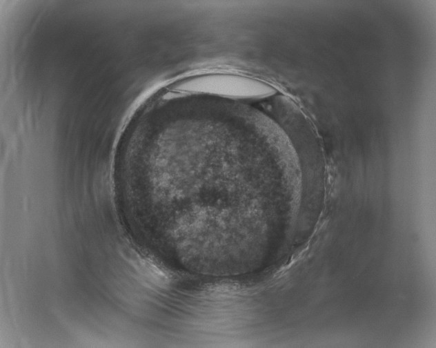 X0000061720200200512161604