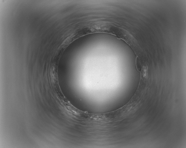 X0000061720915200512161551