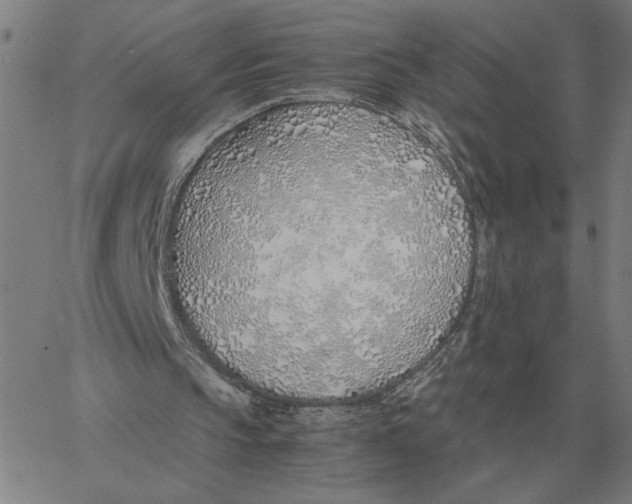 X0000061720145200512231417