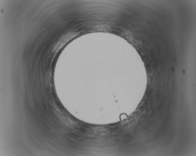 X0000061720146200512231417