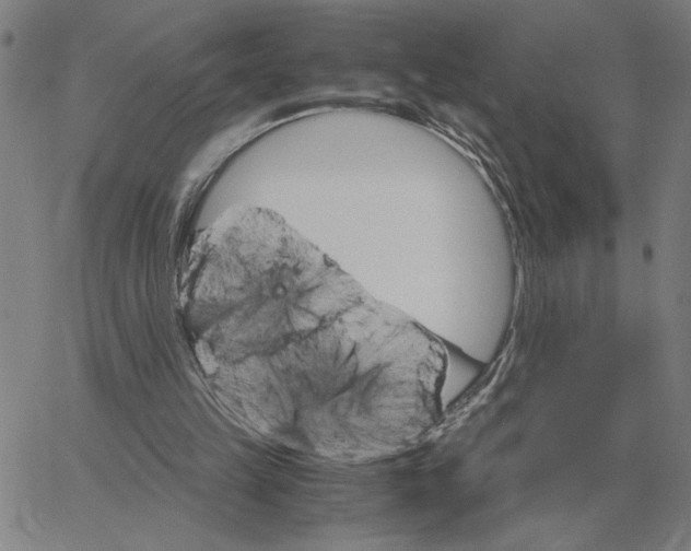 X0000061720149200512231417