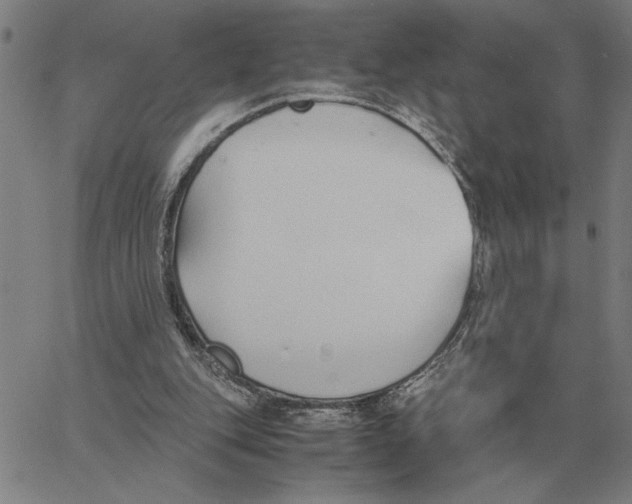 X0000061720151200512231417