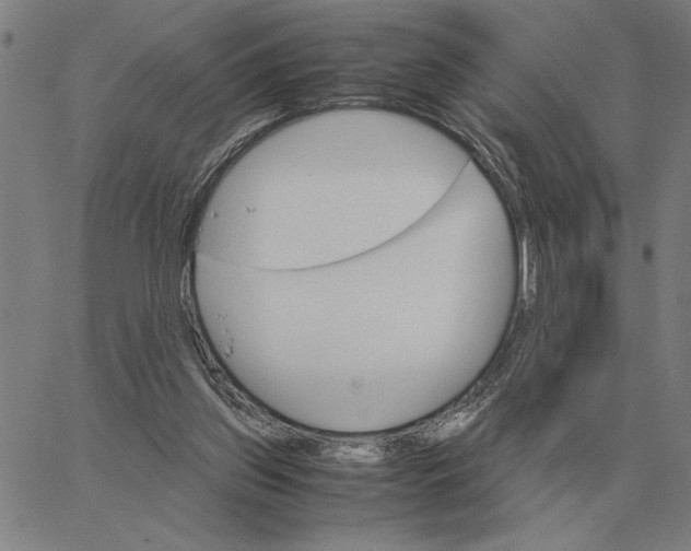 X0000061720157200512231417