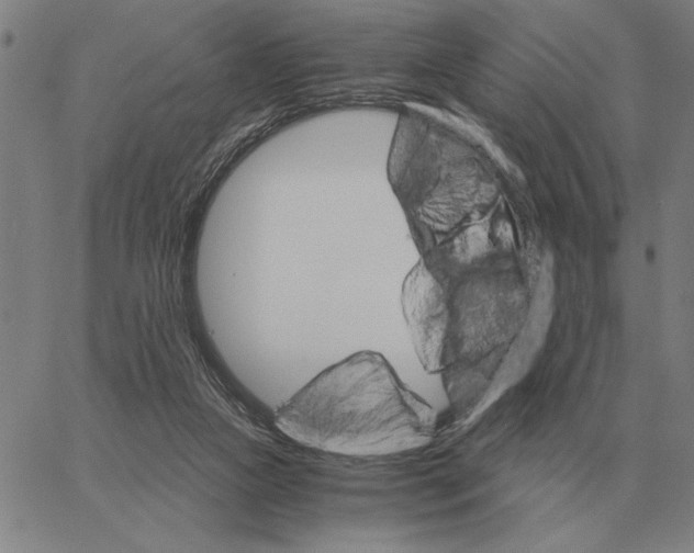 X0000061720161200512231417