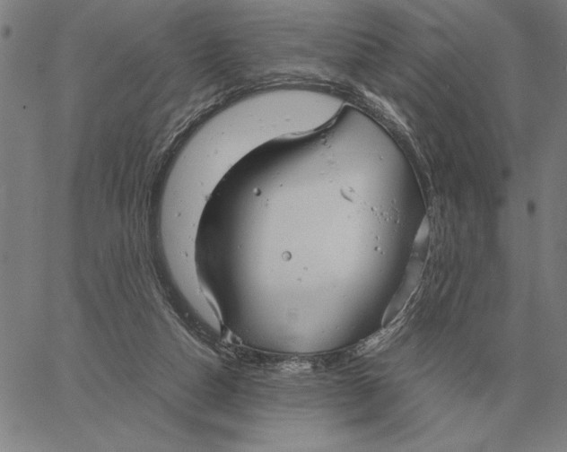 X0000061720162200512231417