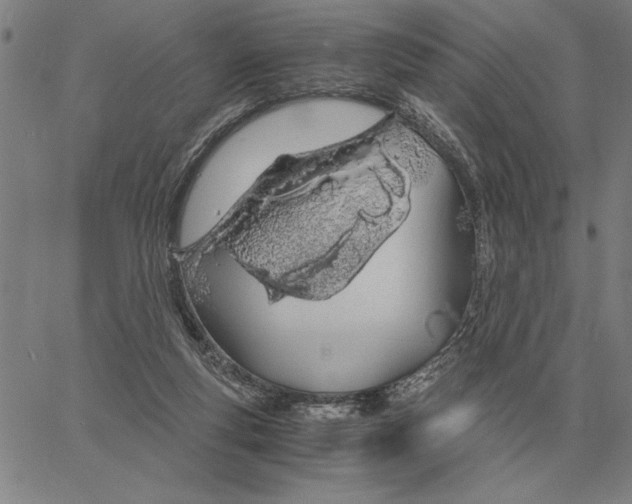 X0000061720163200512231417