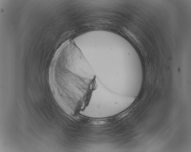 X0000061720169200512231418