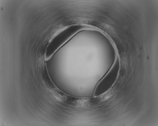 X0000061720172200512231418