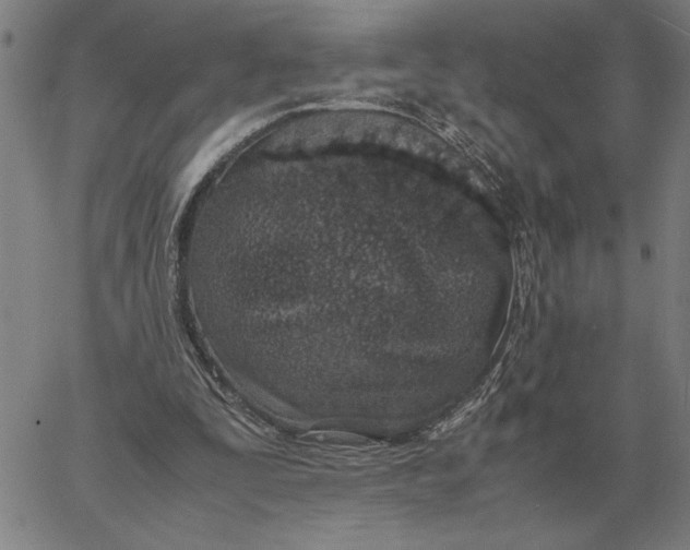 X0000061720295200512231415