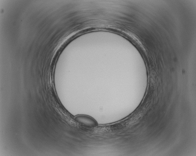 X0000061720887200512231406