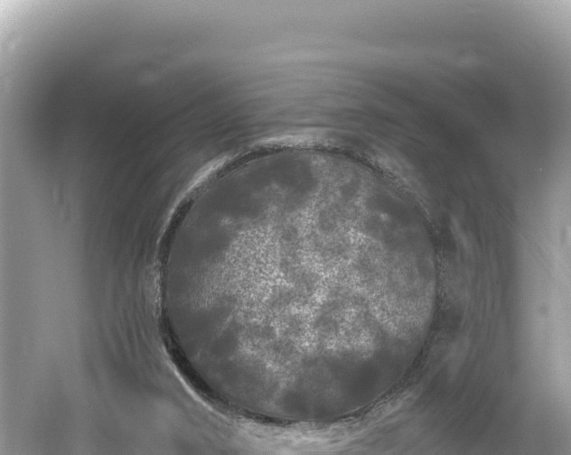 X0000061730016200512050946