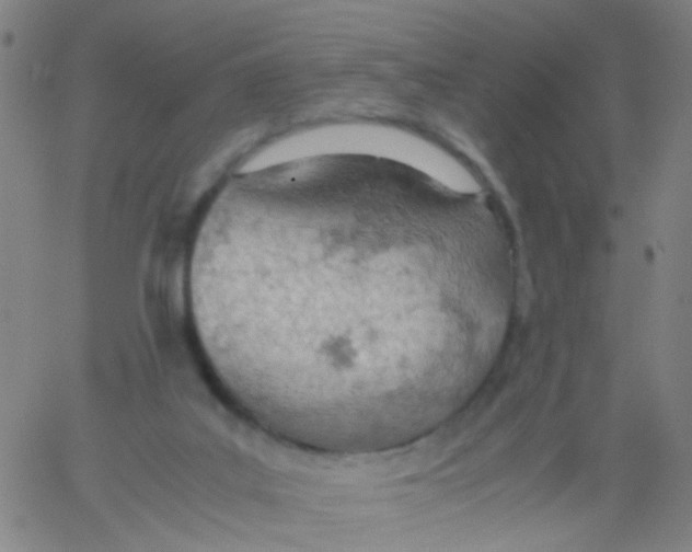 X0000061740019200512231512