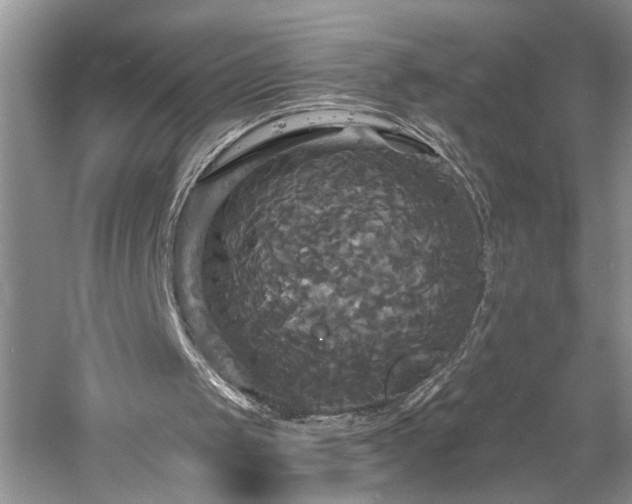 X0000061750049200512021522