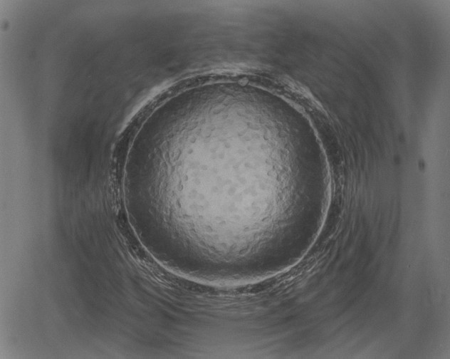 X0000061751256200512050859